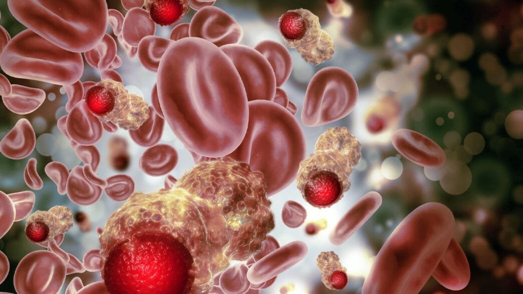 Kolon Polipleri ve Erken Teşhisin Önemi