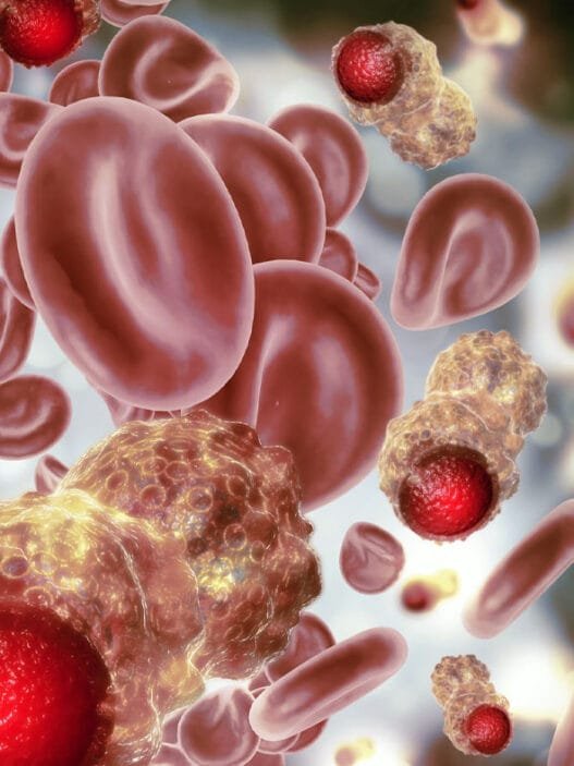 Kolon Polipleri ve Erken Teşhisin Önemi