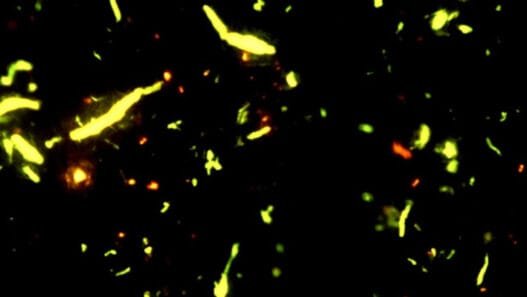 İnsan Beyninde İlk Kez Mikroplastik Tespit Edildi