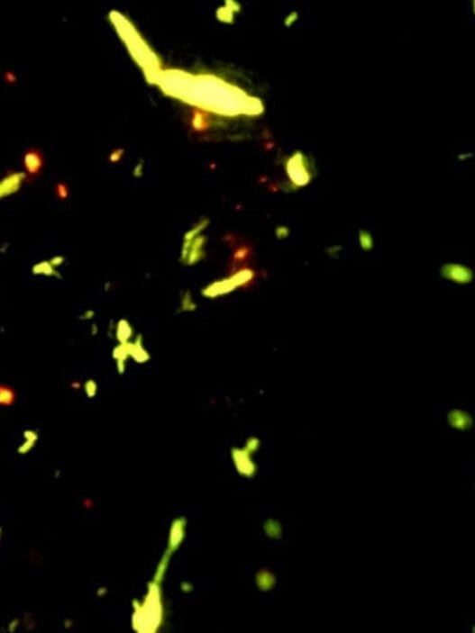 İnsan Beyninde İlk Kez Mikroplastik Tespit Edildi