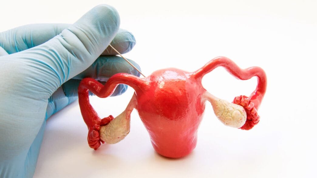 Miyom Nedir? Miyom Belirtileri ve Tedavisi Nasıl Olur?