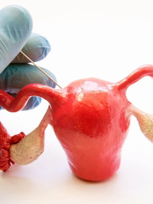 Miyom Nedir? Miyom Belirtileri ve Tedavisi Nasıl Olur?