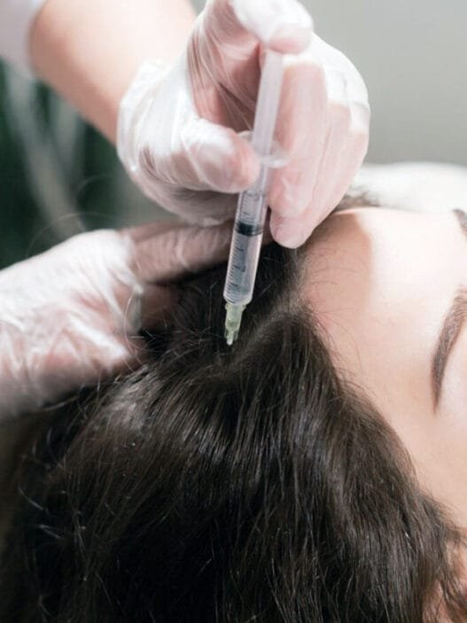 Saç Mezoterapisi