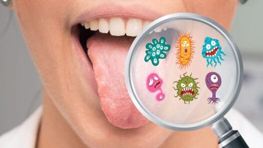Ağız Bakterileri ile Baş ve Boyun Kanserleri Arasında Bağlantı: Araştırma
