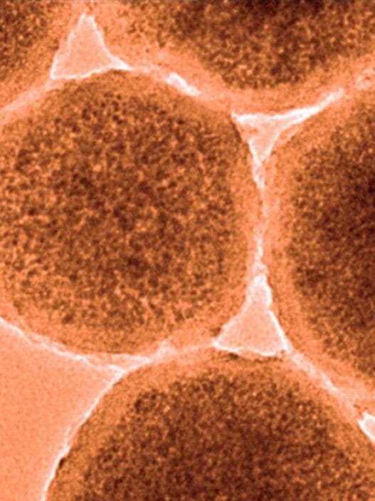 Beyin Kanamasını Durdurabilecek Nanorobotlar Üretildi