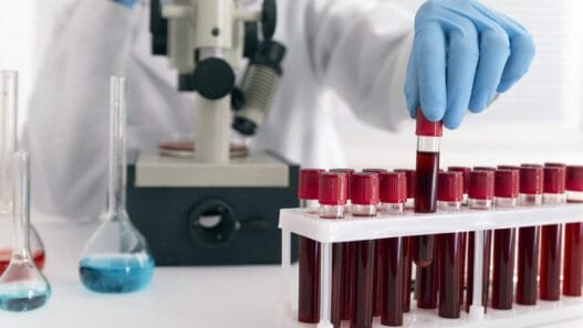 İngiltere’de 50 Yıllık Çalışmalar Sonucunda Yeni Bir Kan Grubu: MAL