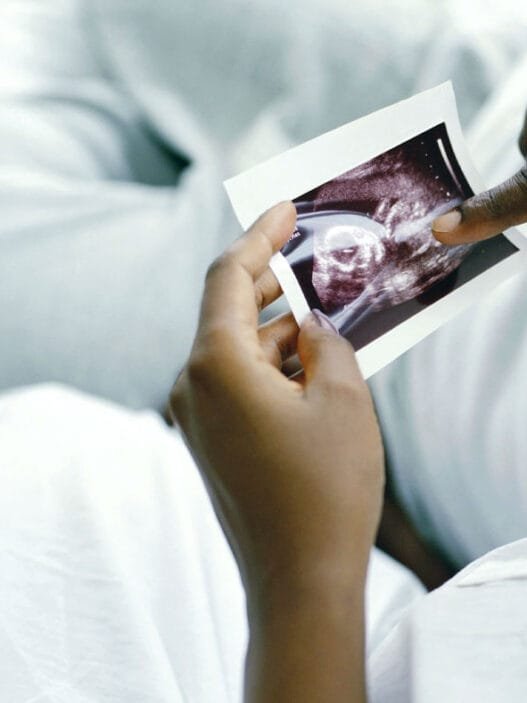 Kısırlık ve Tüp Bebek Tedavisi