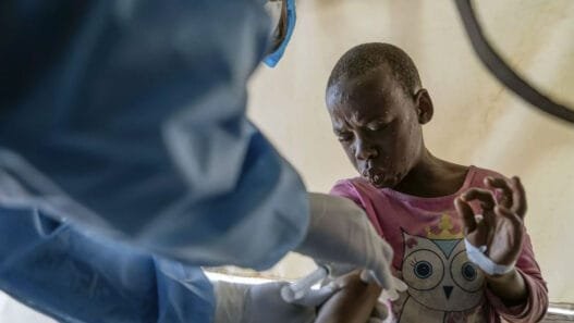Mpox Salgını Afrika’yı Vurdu: Bir Haftada 100’den Fazla Can Kaybı, Aşılama Yetersizliği Sürüyor