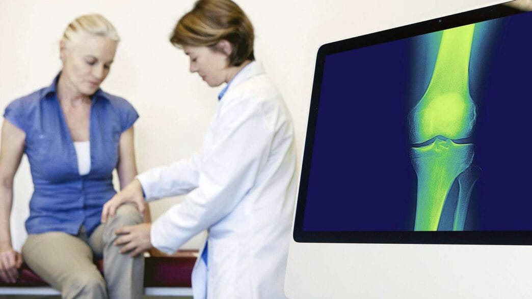 Menopozda Kemik Kaybı