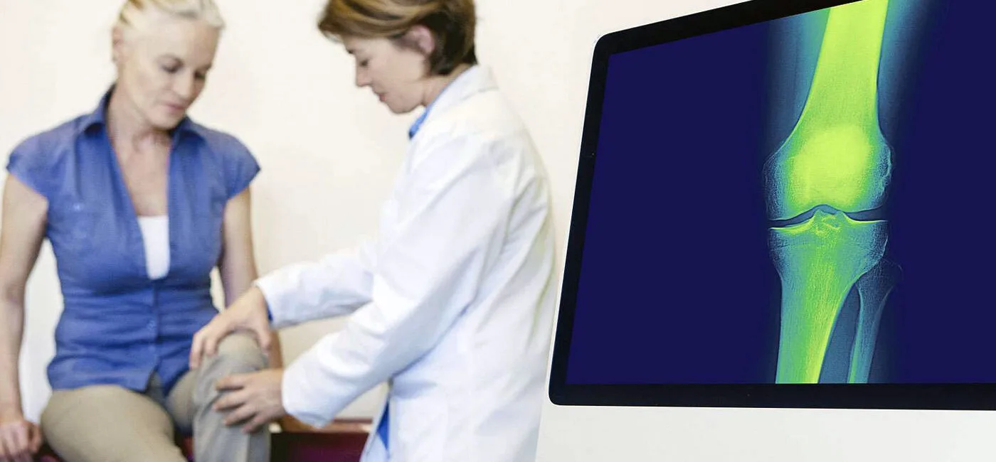 Menopozda Kemik Kaybı Önlenebilir Mi? Menopozda Kemik Kaybı