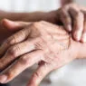 Parkinson Hastalığı