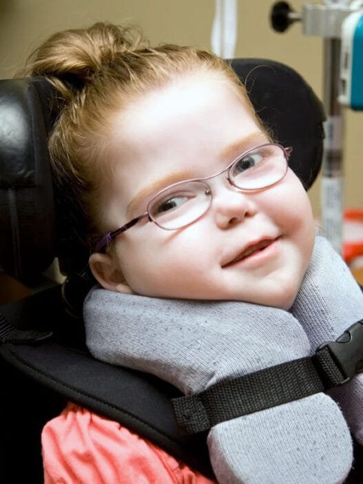 Serebral Palsi Hastalığına yakalanan çocuk