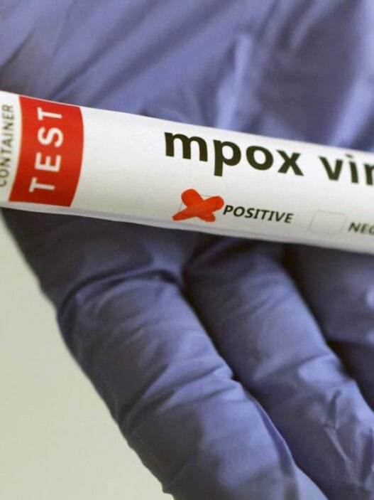 Maymun Çiçeği Virüsü Aşısı