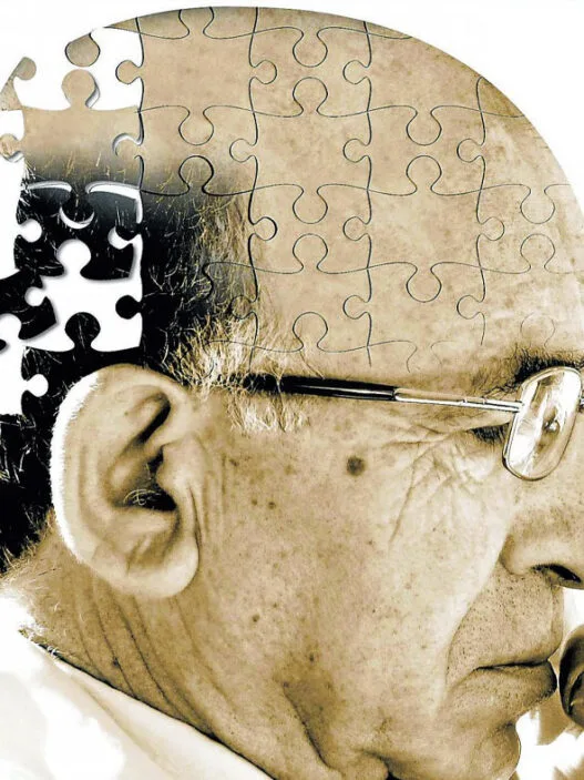Alzheimer