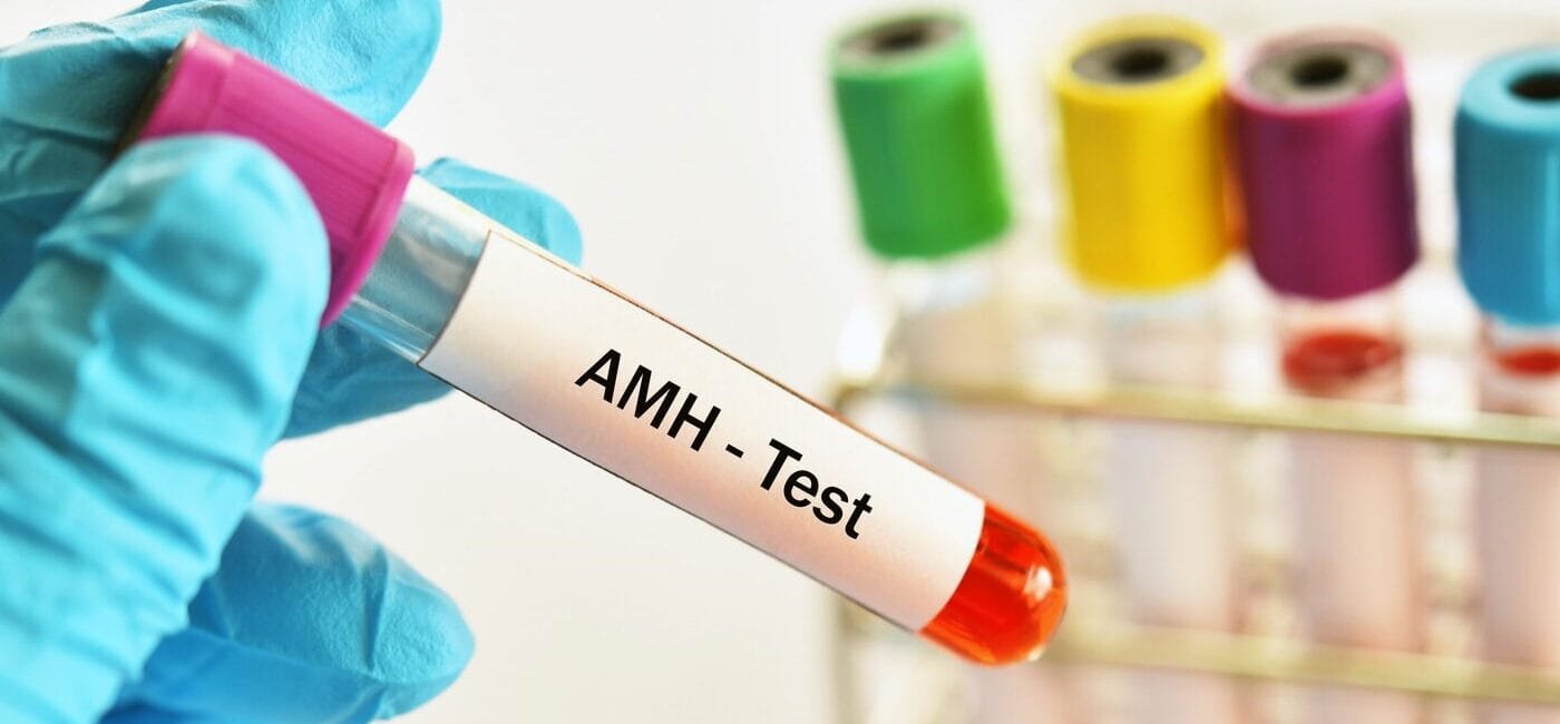 AMH Testi Nedir? Yumurtalık Rezerv Testinin Önemi AMH Testi