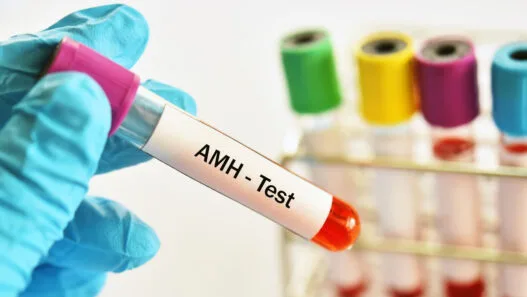 AMH Testi
