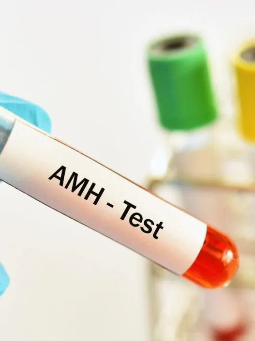 AMH Testi