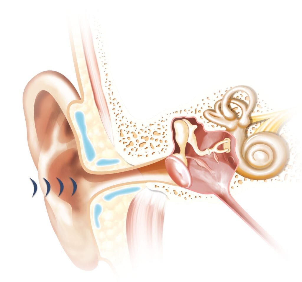 İşitme İmpantı Çalışma Sistemi