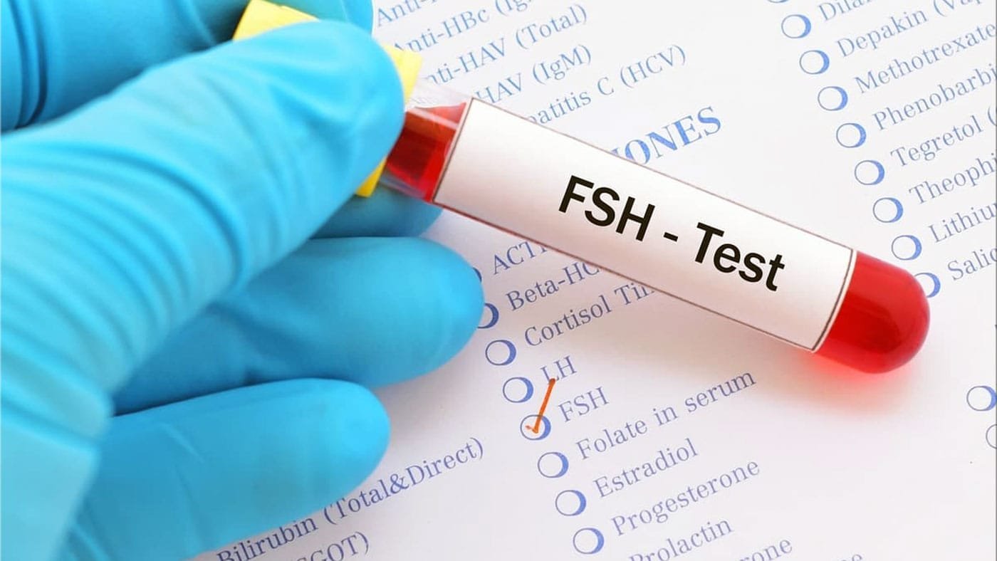 FSH Testinin Önemi