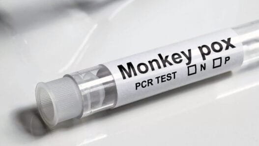 İngiltere, Avrupa’da İlk Ev İçi Bulaşmaları İçeren İki Yeni Maymun Çiçeği Vakası Tespit Etti