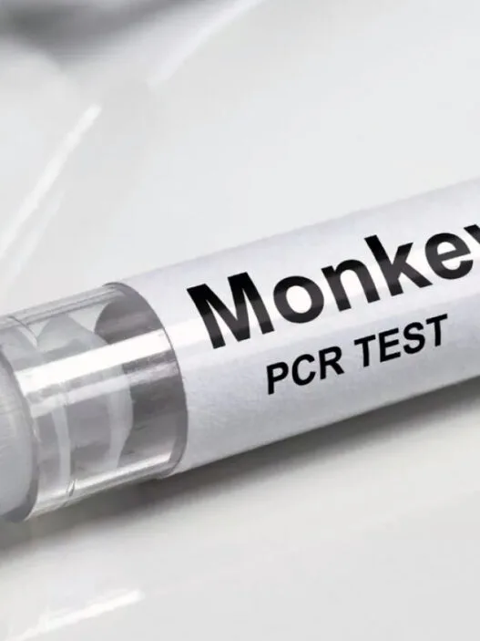 Monkey Pox Testi