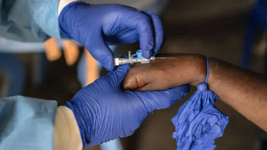 Mpox Salgını Aşısı
