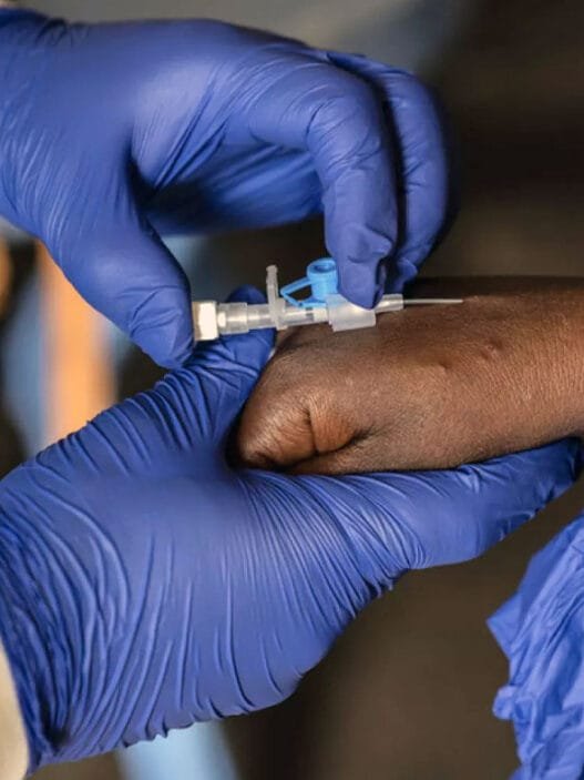 Mpox Salgını Aşısı