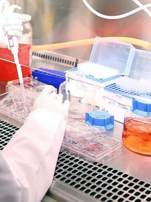 Yapay Zeka ile Kanser Tanısı