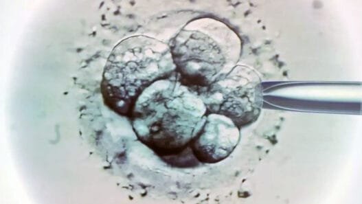 Dondurulmuş Embriyolardan Doğan Çocuklarda Kanser Riski Artabilir