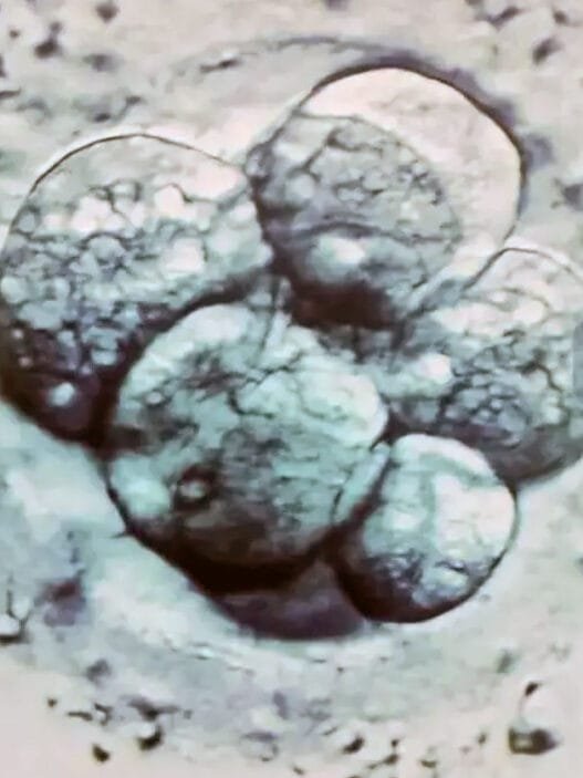 Dondurulmuş Embriyo