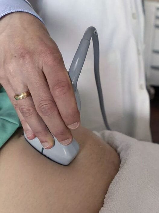 Tüp Bebek (IVF) Tedavisi