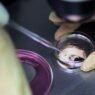Tüp Bebek Tedavisinde Embriyolar