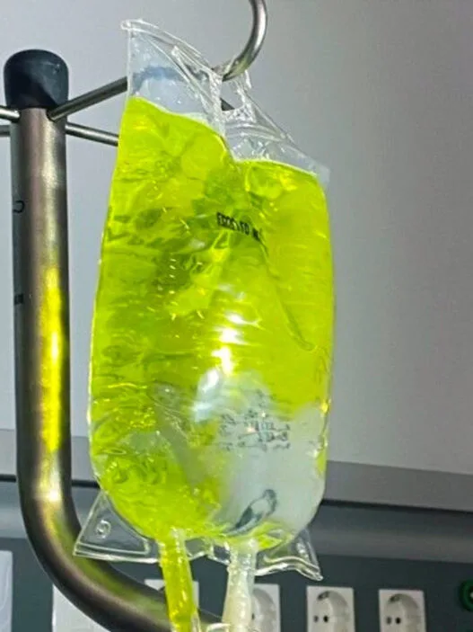 Sarı Serum