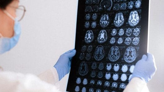 Alzheimer Araştırmalarında Çığır Açan Keşif: Tau Proteini Hastalığın Anahtar Oyuncusu Olabilir