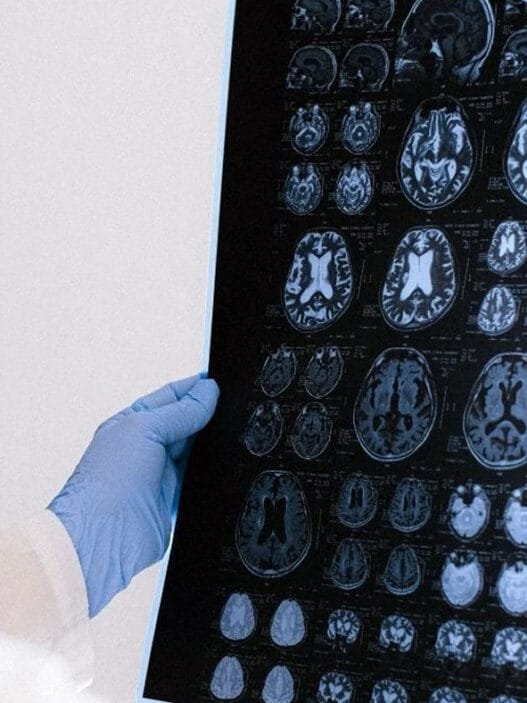 Alzheimer Araştırması