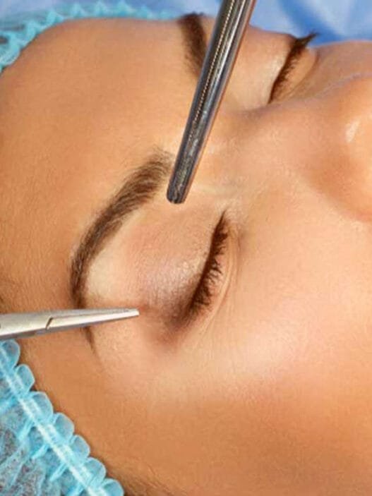 Göz Kapağı Estetiği