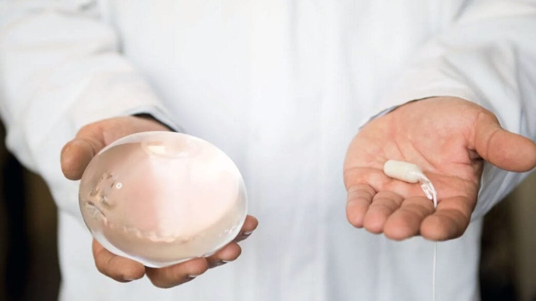 Yutulabilir Mide Balonu